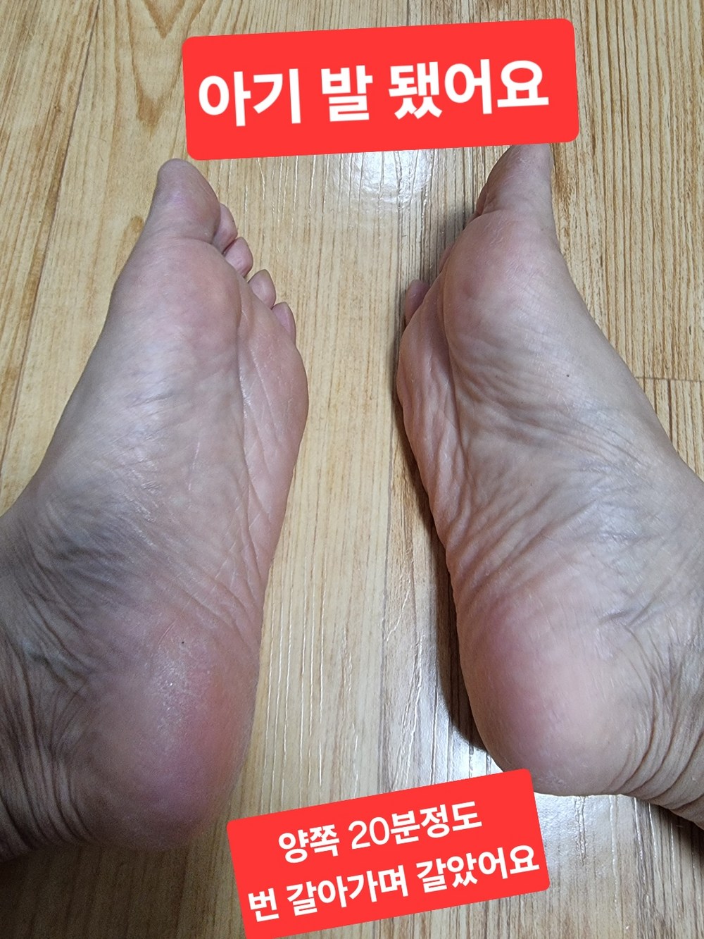 발르가즘 안전한 발 뒷꿈치 각질제거기 구매 후기 이미지