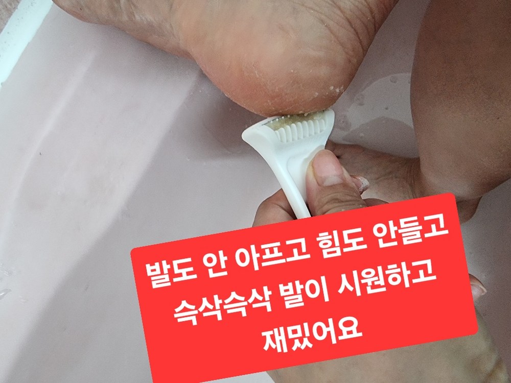 발르가즘 안전한 발 뒷꿈치 각질제거기 구매 후기 이미지